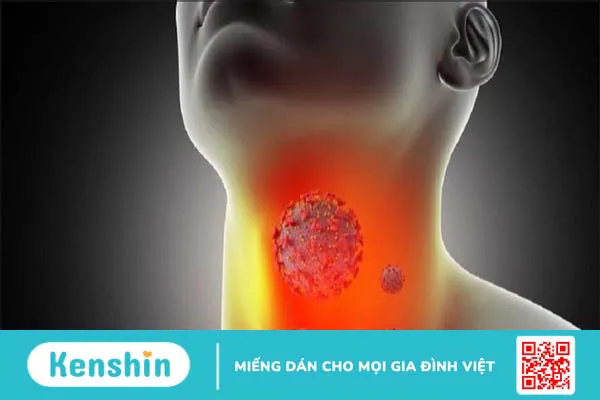 8 xét nghiệm chẩn đoán ung thư vòm họng giúp phát hiện bệnh sớm nhất