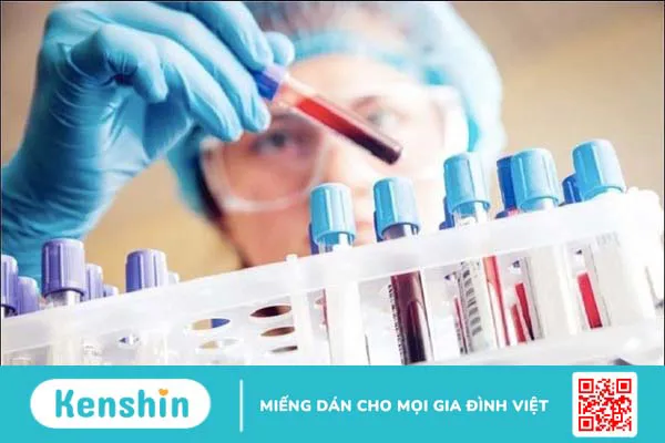 8 xét nghiệm chẩn đoán ung thư vòm họng giúp phát hiện bệnh sớm nhất