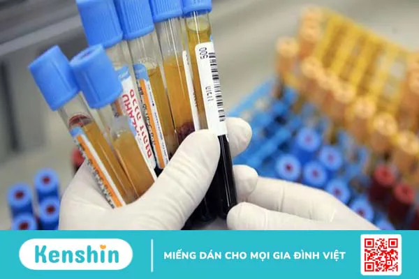 8 xét nghiệm chẩn đoán ung thư vòm họng giúp phát hiện bệnh sớm nhất