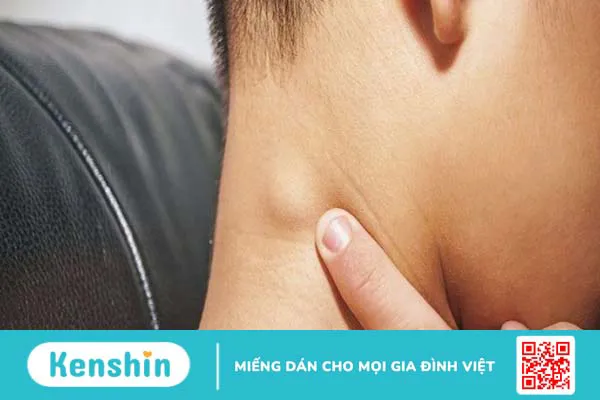 8 xét nghiệm chẩn đoán ung thư vòm họng giúp phát hiện bệnh sớm nhất