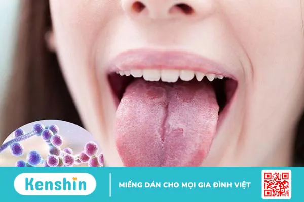 9 biến chứng bệnh lỵ cần lưu ý để tránh khỏi