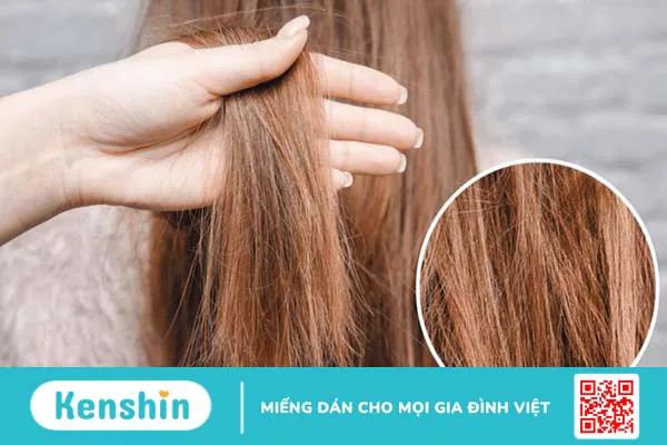 9 cách trị rụng tóc tại nhà từ những thói quen đơn giản, hiệu quả