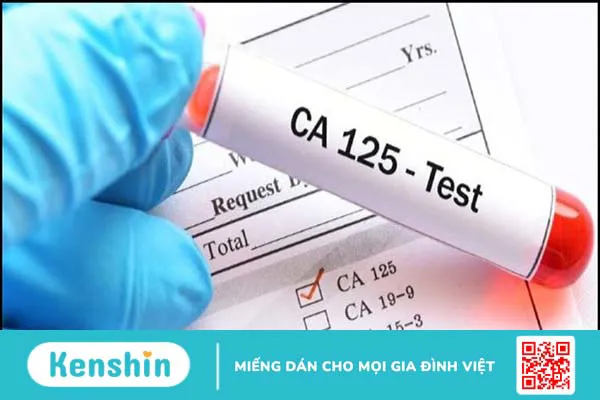 9 dấu hiệu ung thư buồng trứng cần biết để điều trị kịp thời