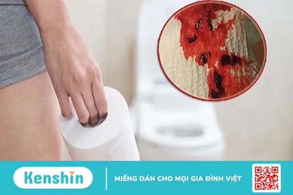 9 dấu hiệu ung thư đại tràng giai đoạn 1 bạn không nên chủ quan