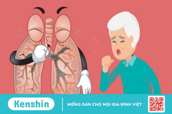 9 dấu hiệu ung thư phổi giai đoạn đầu tuyệt đối đừng bỏ qua!