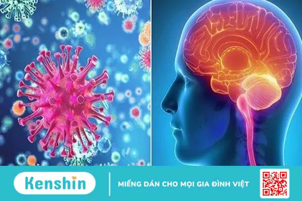 9 di chứng thần kinh hậu Covid và cách điều trị tại nhà hiệu quả