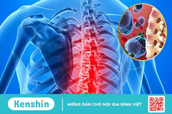 9 di chứng thần kinh hậu Covid và cách điều trị tại nhà hiệu quả