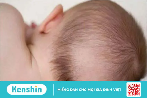 9 mẹo dân gian hỗ trợ chữa méo đầu ở trẻ sơ sinh hiệu quả