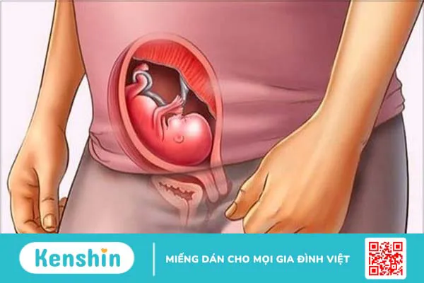 9 mẹo dân gian hỗ trợ chữa méo đầu ở trẻ sơ sinh hiệu quả