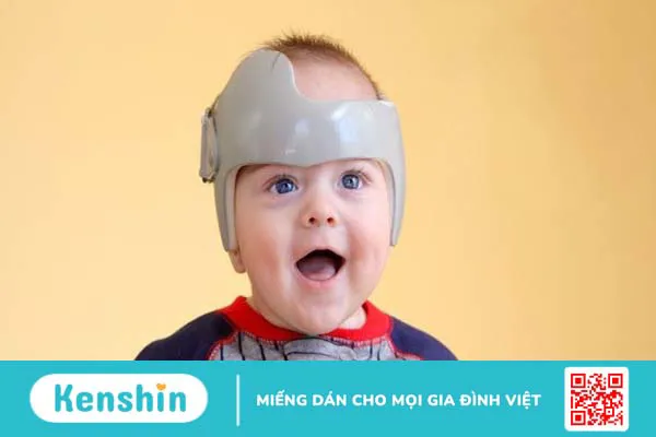 9 mẹo dân gian hỗ trợ chữa méo đầu ở trẻ sơ sinh hiệu quả