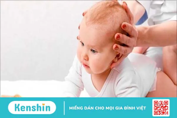 9 mẹo dân gian hỗ trợ chữa méo đầu ở trẻ sơ sinh hiệu quả