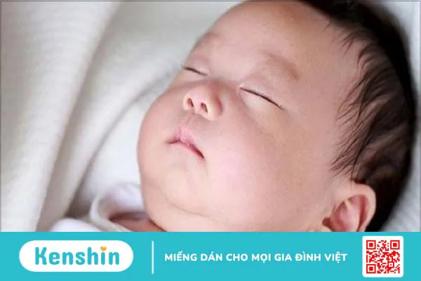 9 mẹo dân gian hỗ trợ chữa méo đầu ở trẻ sơ sinh hiệu quả