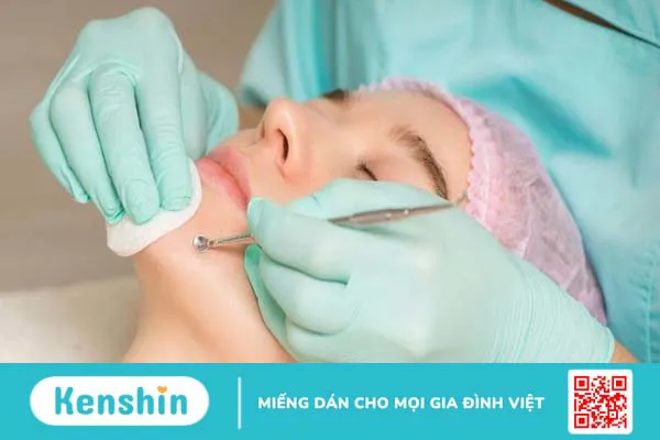 9 nguyên nhân dùng kem dưỡng ẩm bị nổi mụn và cách khắc phục hiệu quả