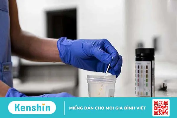 9 nguyên nhân viêm ruột thừa điển hình bạn cần phải lưu ý