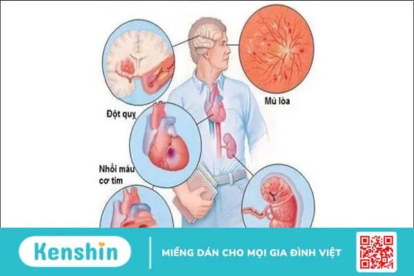 9 tác dụng phụ của thuốc huyết áp thường gặp bạn cần lưu ý