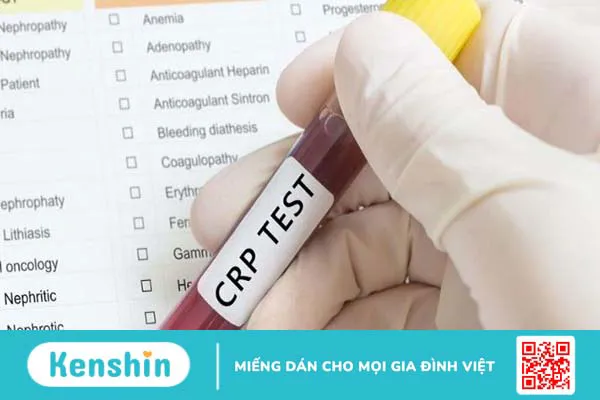 Acid alpha lipoic (ALA) là gì? Công dụng, cách dùng, tác dụng phụ, thực phẩm chứa ALA