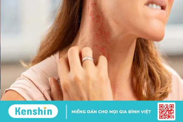 Ăn chuối có tác dụng gì? 16 tác dụng của chuối với sức khỏe