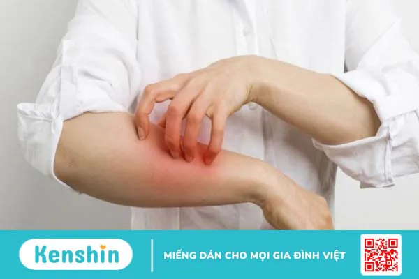 Ăn hạt hướng dương có tác dụng gì? 16 tác dụng và lưu ý khi ăn