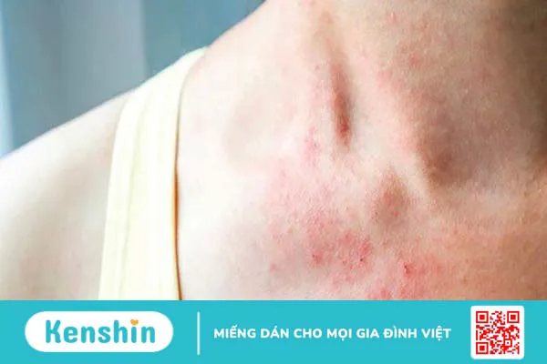 Ăn mướp có tốt không? 19 tác dụng tuyệt vời của mướp và lưu ý khi ăn