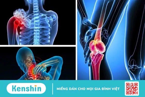 Ăn nhiều cà chua có hại không? 11 tác hại của cà chua bạn không nên xem thường