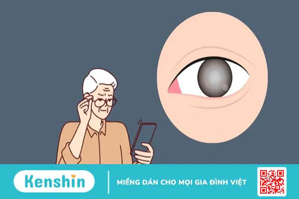 Ăn ớt có tốt cho mắt không? Lợi ích của ớt đối với mắt và sức khỏe