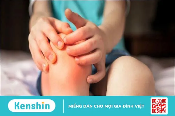 Ăn ớt có tốt cho mắt không? Lợi ích của ớt đối với mắt và sức khỏe