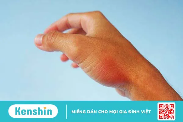 Ăn ớt có tốt cho mắt không? Lợi ích của ớt đối với mắt và sức khỏe