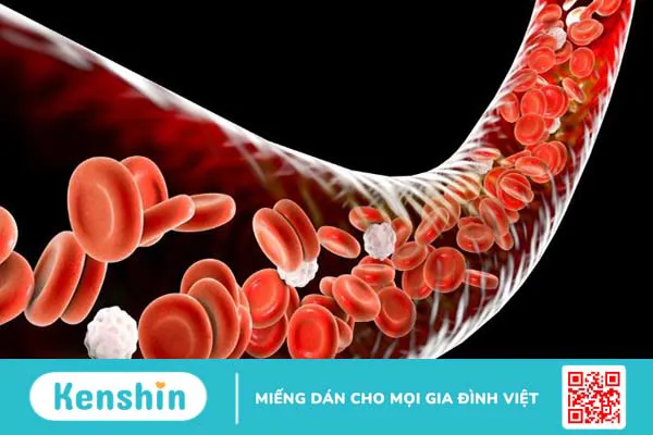 Ăn ớt có tốt cho mắt không? Lợi ích của ớt đối với mắt và sức khỏe