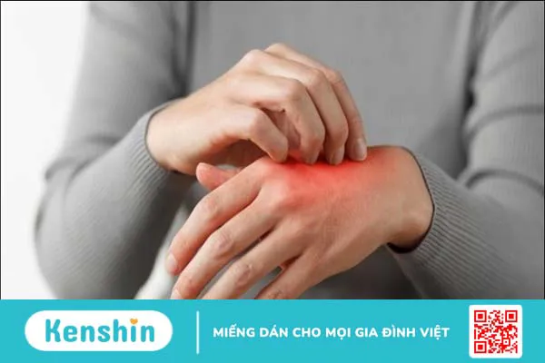 Ăn ớt có tốt cho mắt không? Lợi ích của ớt đối với mắt và sức khỏe