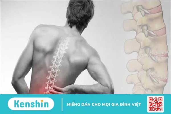 Ăn tôm có tác dụng gì? 11 tác dụng của tôm và tác hại khi ăn nhiều