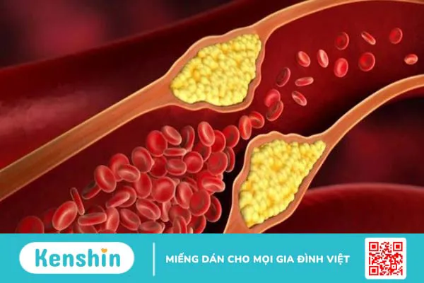 Ăn tôm có tác dụng gì? 11 tác dụng của tôm và tác hại khi ăn nhiều