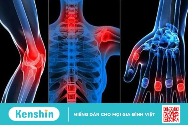 Ăn vải có tốt không? 20 tác dụng của quả vải và các lưu ý khi ăn vải