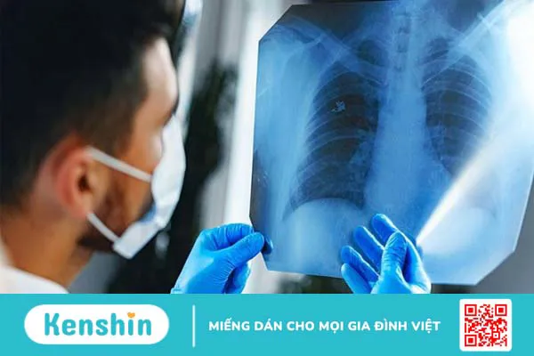 Ăn vải có tốt không? 20 tác dụng của quả vải và các lưu ý khi ăn vải