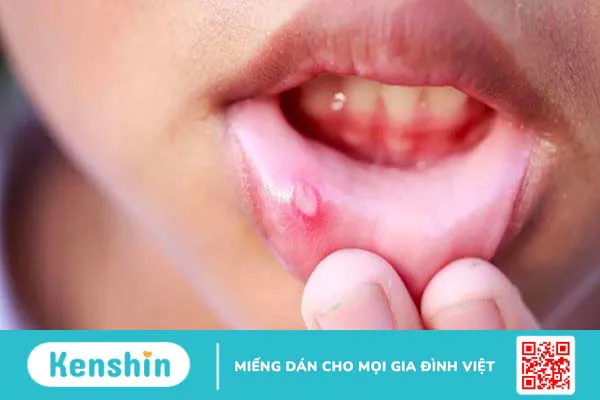 Ăn vải có tốt không? 20 tác dụng của quả vải và các lưu ý khi ăn vải