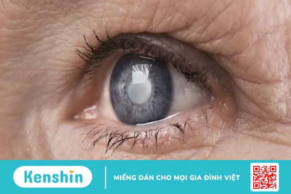 Ánh sáng xanh là gì? 9 tác hại của ánh sáng xanh với đôi mắt