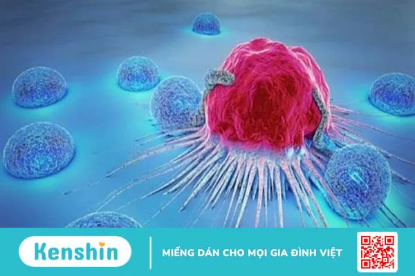 Ánh sáng xanh là gì? 9 tác hại của ánh sáng xanh với đôi mắt