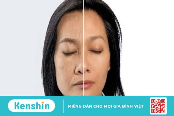 Ánh sáng xanh là gì? 9 tác hại của ánh sáng xanh với đôi mắt