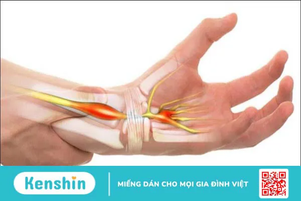 Astaxanthin là gì? 13 tác dụng, cách dùng, tác dụng phụ của astaxanthin