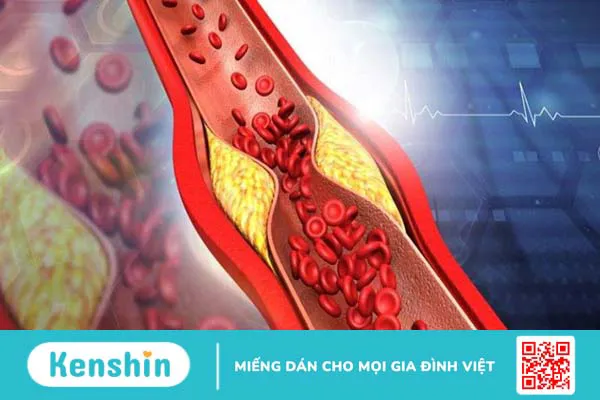 Astaxanthin là gì? 13 tác dụng, cách dùng, tác dụng phụ của astaxanthin