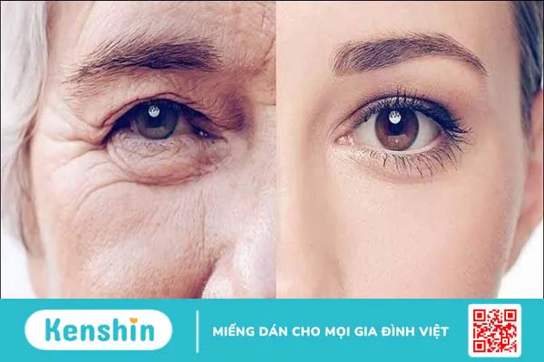 Astaxanthin là gì? 13 tác dụng, cách dùng, tác dụng phụ của astaxanthin