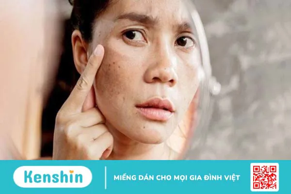 Atiso là gì? Tác dụng, cách dùng, tác dụng phụ của Atiso