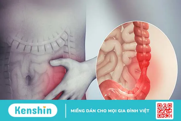 Atiso là gì? Tác dụng, cách dùng, tác dụng phụ của Atiso