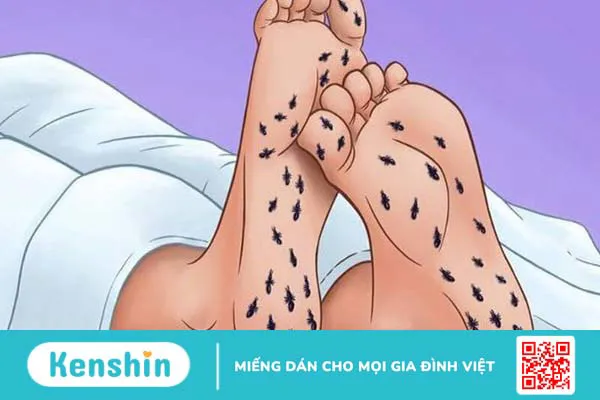 Axit alpha lipoic và chăm sóc bệnh thần kinh ở người tiểu đường