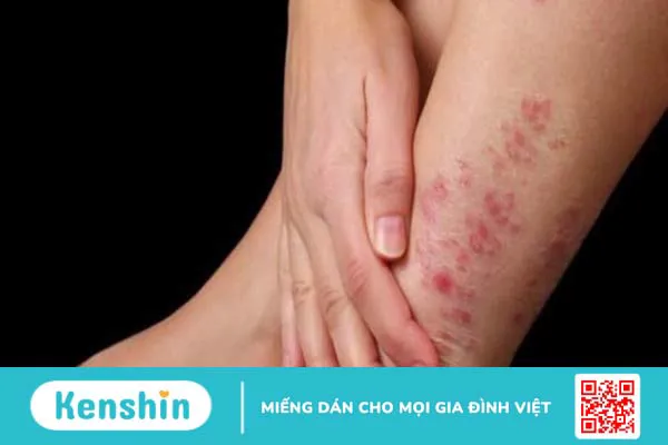 Bà bầu ăn mít được không? 10 lợi ích sức khỏe và 4 tác hại với thai kỳ