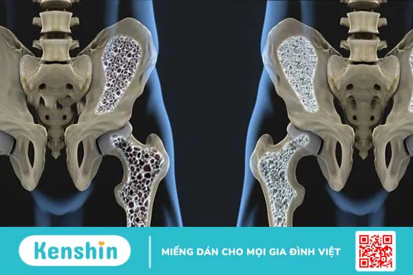 Bà bầu uống sữa đậu nành được không? Có ảnh hưởng giới tính thai nhi?