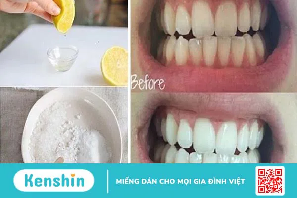 Baking soda là gì? 22 công dụng của baking soda có thể bạn chưa biết