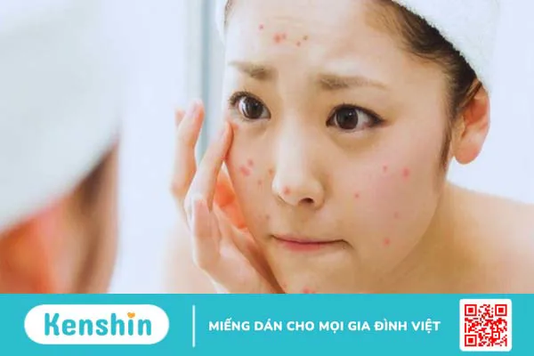 Bánh pía bao nhiêu calo? Ăn bánh pía có mập không? Cách ăn ít tăng cân