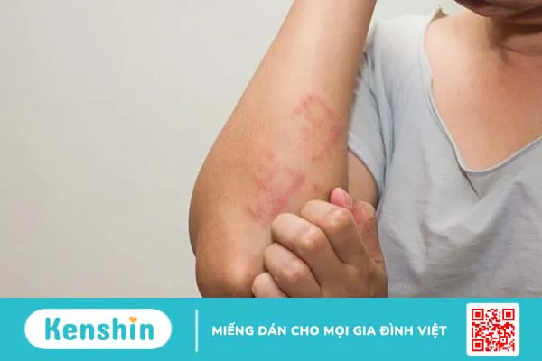 Bắp ngô bao nhiêu calo? Ăn bắp có béo không, các lưu ý khi ăn bắp