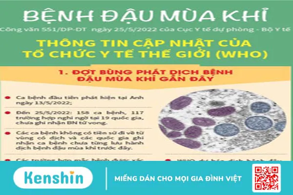 Bệnh đậu mùa khỉ và những điều nên biết