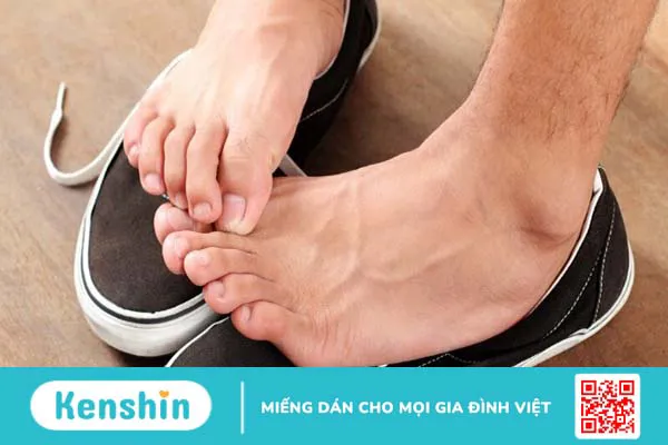 Bệnh nấm kẽ chân (nước ăn chân) – bệnh thường gặp mùa mưa bạn cần biết